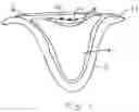 Fig. 02 - Soil-less seed support medium and method for germinating a seed
