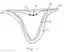 Fig. 03 - Soil-less seed support medium and method for germinating a seed