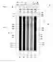 Fig. 02 - Acoustic wave array chemical and biological sensor