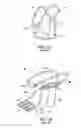 Fig. 02 - Temporary projectile retaining apparatus and related methods