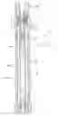 Fig. 01 - Core barrel capacity gauge and method
