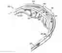 Fig. 01 - Eyewear with forehead-ventilating provisions