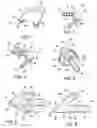Fig. 02 - Eyeglass retainer