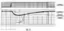 Fig. 04 - SRAM memory device with improved write operation and method thereof
