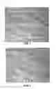 Fig. 02 - Method and system for imaging to identify vascularization