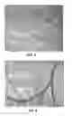 Fig. 03 - Method and system for imaging to identify vascularization