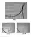 Fig. 04 - Method and system for imaging to identify vascularization