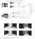 Fig. 02 - System and method for automated patient anatomy localization