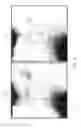 Fig. 14 - DRR generation using a non-linear attenuation model