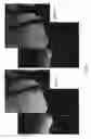 Fig. 06 - Gaussian noise rejection with directional variance capabilities for use in image processing