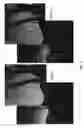 Fig. 07 - Gaussian noise rejection with directional variance capabilities for use in image processing