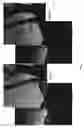 Fig. 08 - Gaussian noise rejection with directional variance capabilities for use in image processing