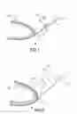 Fig. 02 - Method and coating for protecting and repairing an airfoil surface using molded boots, sheet or tape