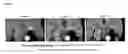 Fig. 02 - Metal chelates having a perfluorinated PEG radical, processes for their preparation, and their use
