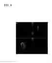 Fig. 05 - Macromolecular delivery systems for non-invasive imaging, evaluation and treatment of arthritis and other inflammatory diseases