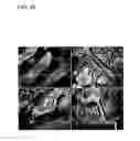 Fig. 11 - Macromolecular delivery systems for non-invasive imaging, evaluation and treatment of arthritis and other inflammatory diseases