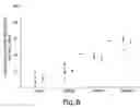 Fig. 09 - Transplants for myocardial scars