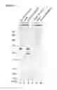 Fig. 07 - Method of screening for agents that modulate Tysnd1 level or activity in a cell.