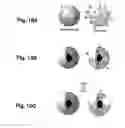 Fig. 08 - Laser-activated nanothermolysis of cells