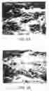 Fig. 04 - Implant surface preparation