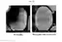 Fig. 08 - Double-layer cathode active materials for lithium secondary batteries, method for preparing the active materials, and lithium secondary batteries using the active materials