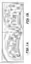 Fig. 02 - Method of orthodontic treatment