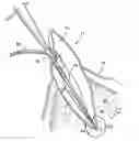 Fig. 01 - Apparatus for Evacuation of Root Canal