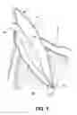 Fig. 02 - Apparatus for Evacuation of Root Canal