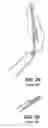 Fig. 03 - Apparatus for Evacuation of Root Canal