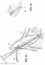 Fig. 04 - Apparatus for Evacuation of Root Canal