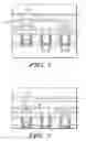 Fig. 02 - Top contact alignment in semiconductor devices