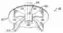 Fig. 01 - Abrasive configuration for fluid dynamic removal of abraded material and the like
