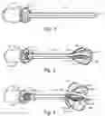 Fig. 02 - Expandable Brachytherapy Device with Constant Radiation Source Spacing