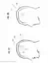 Fig. 04 - Method and system for displaying the electric field generated on the brain by transcranial magnetic stimulation
