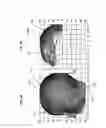 Fig. 06 - Method and system for displaying the electric field generated on the brain by transcranial magnetic stimulation