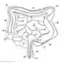 Fig. 01 - Advancement techniques for gastrointestinal tool with guiding element