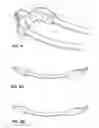 Fig. 04 - Surgical access system and method of using the same