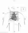 Fig. 01 - Cardiac navigation system including electrode array for use therewith