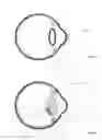 Fig. 09 - Method and system for adaptive vision modification
