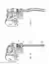 Fig. 17 - Methods relating to microsurgical robot system