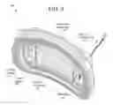 Fig. 04 - Systems and methods for integrating a navigation field replaceable unit into a fluoroscopy system