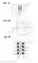 Fig. 03 - Ultrasonic imaging apparatus and a method for displaying diagnostic images