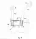 Fig. 02 - EXAMINING DEVICE FOR EXAMINING AN AORTIC VALVE AND A PULMONARY VALVE COMPETENCY