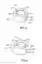 Fig. 04 - EXAMINING DEVICE FOR EXAMINING AN AORTIC VALVE AND A PULMONARY VALVE COMPETENCY