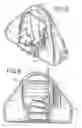 Fig. 05 - Infusion pump