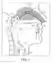 Fig. 02 - Nasal delivery devices