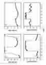 Fig. 02 - Apparatus and method for delivering ophthalmic fluid