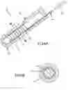 Fig. 07 - Contact-sensitive pressure-sensitive conductive composite electrode and method for ablation