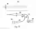Fig. 09 - Irrigated ablation catheter system with pulsatile flow to prevent thrombus