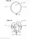 Fig. 08 - Composite structures and methods for ablating tissue to form complex lesion patterns in the treatment of cardiac conditions and the like